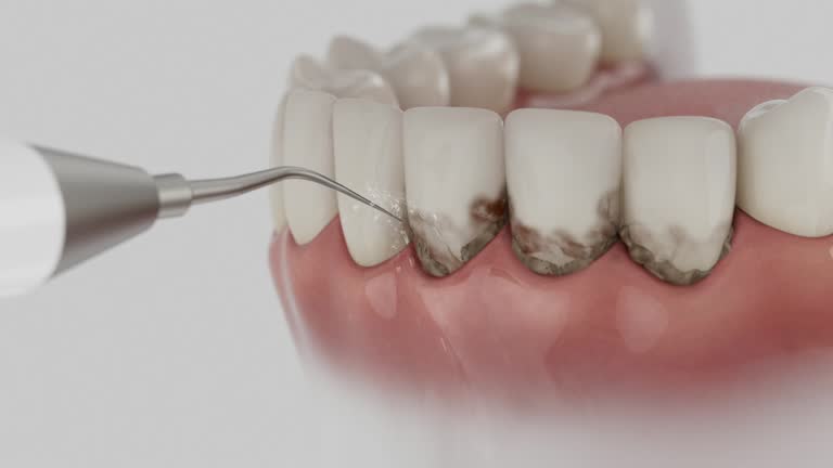 Trusted Teeth Cleaning And Checkup service in Hot Springs, SD - Dentist Open Now